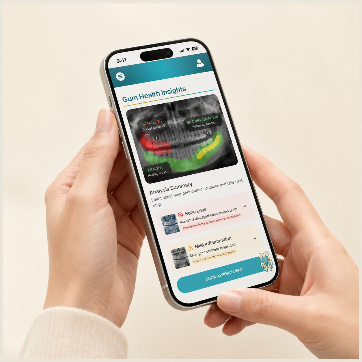 Perio ai app screen showing Gum Health Insights with an annotated X-ray overlay